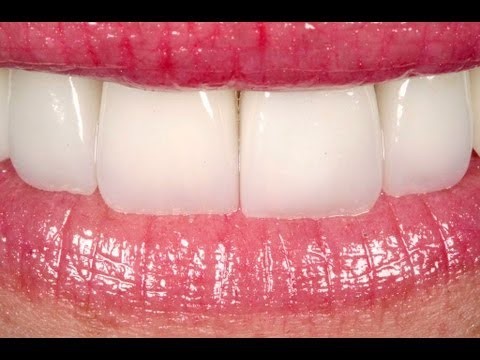 Clínica de Estética Dentaria