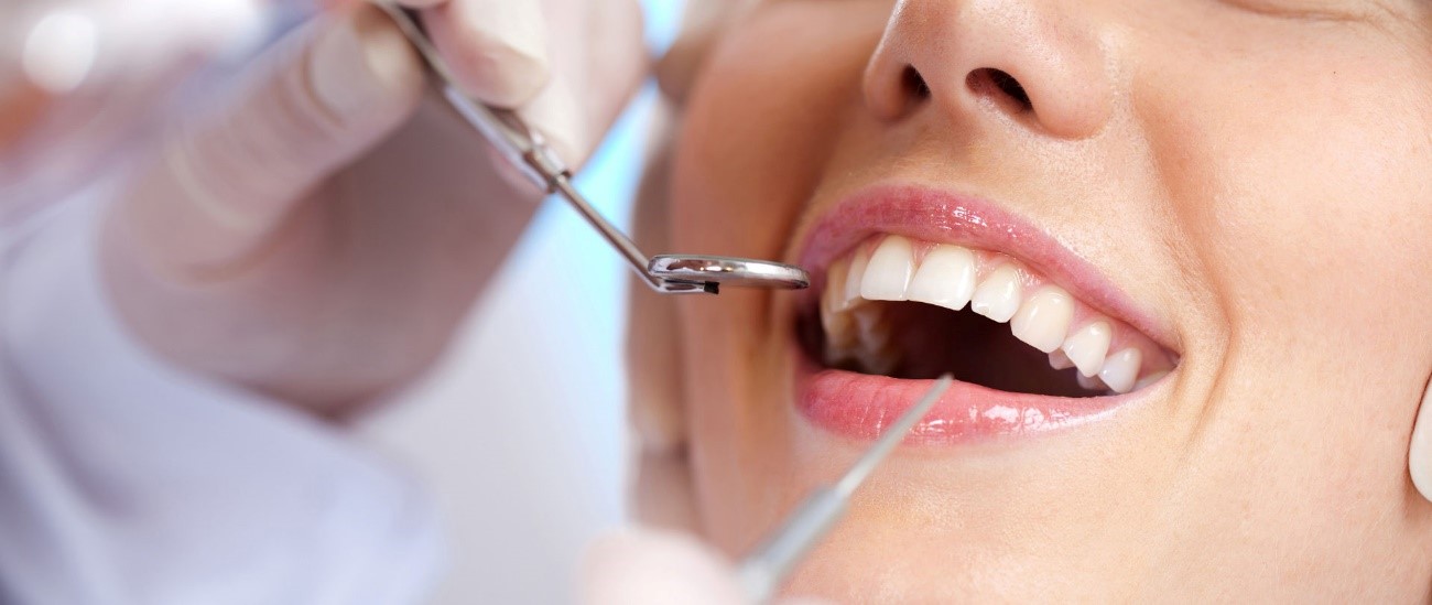 implantes-dentario-preco